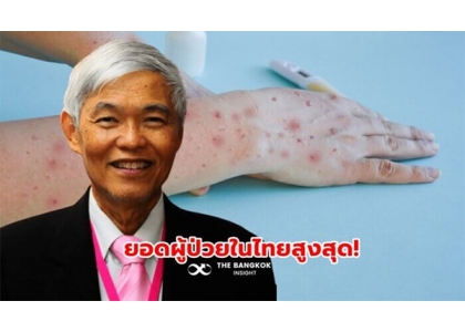 2023–08-02 泰国在东南亚国家患猴痘人数中最多